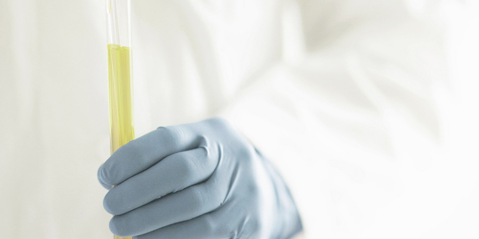 ACS Nano：突破！科學(xué)家利用來自尿液的生物標(biāo)志物進行早期癌癥篩查